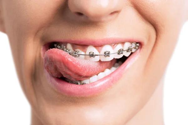 Thrive Dental and Orthodontics Dallas Offering Orthodontic Solutions